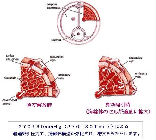 �~�X�^�[�n�C�^�󔭐����u�i�g��Ǝ��k�Q�j